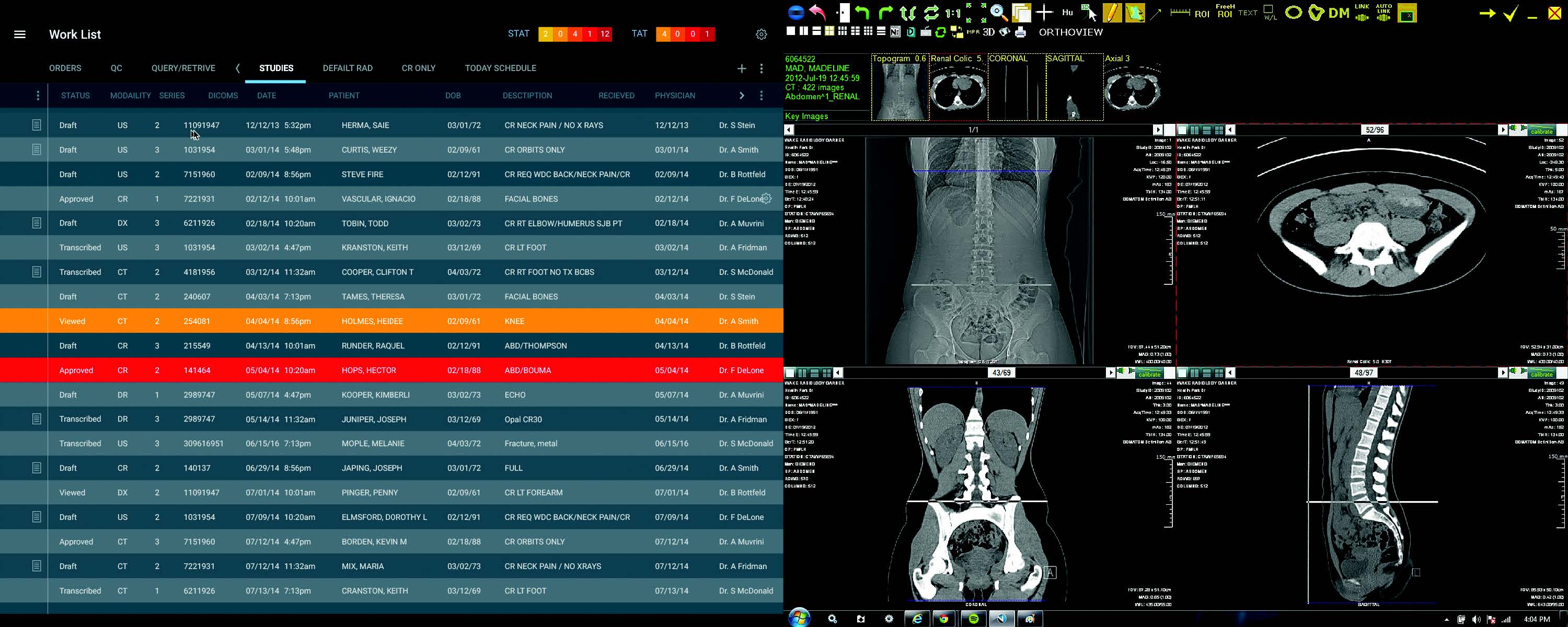 exa PACS dual screen configuratioin