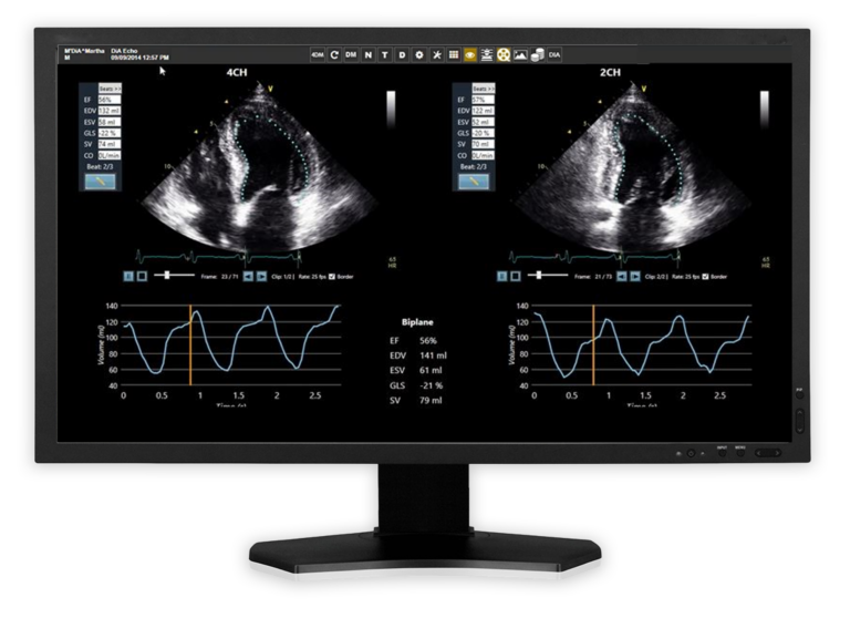exa cardio ultrasound analysis screen