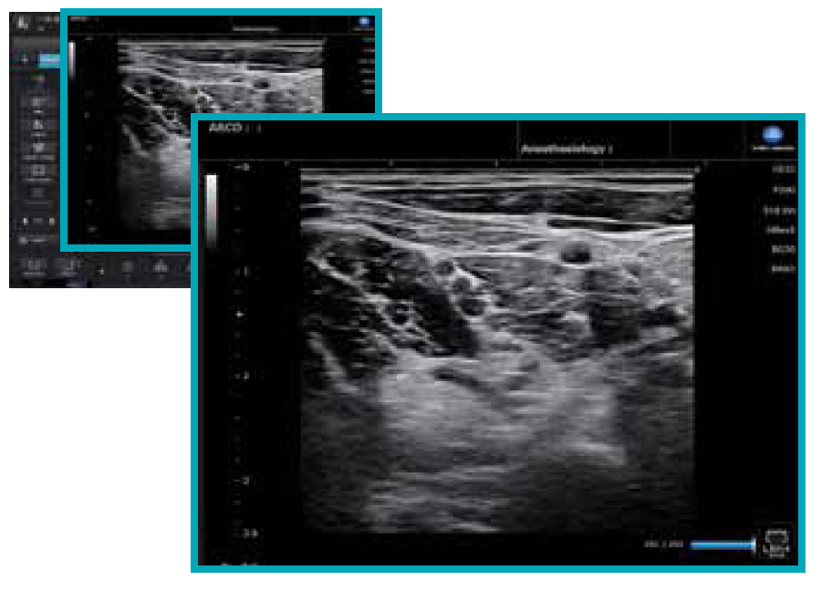 sonimage hs2 screen full display mode