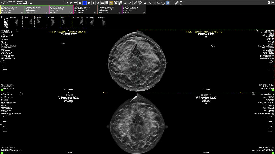 Exa mammo sample screen image 1