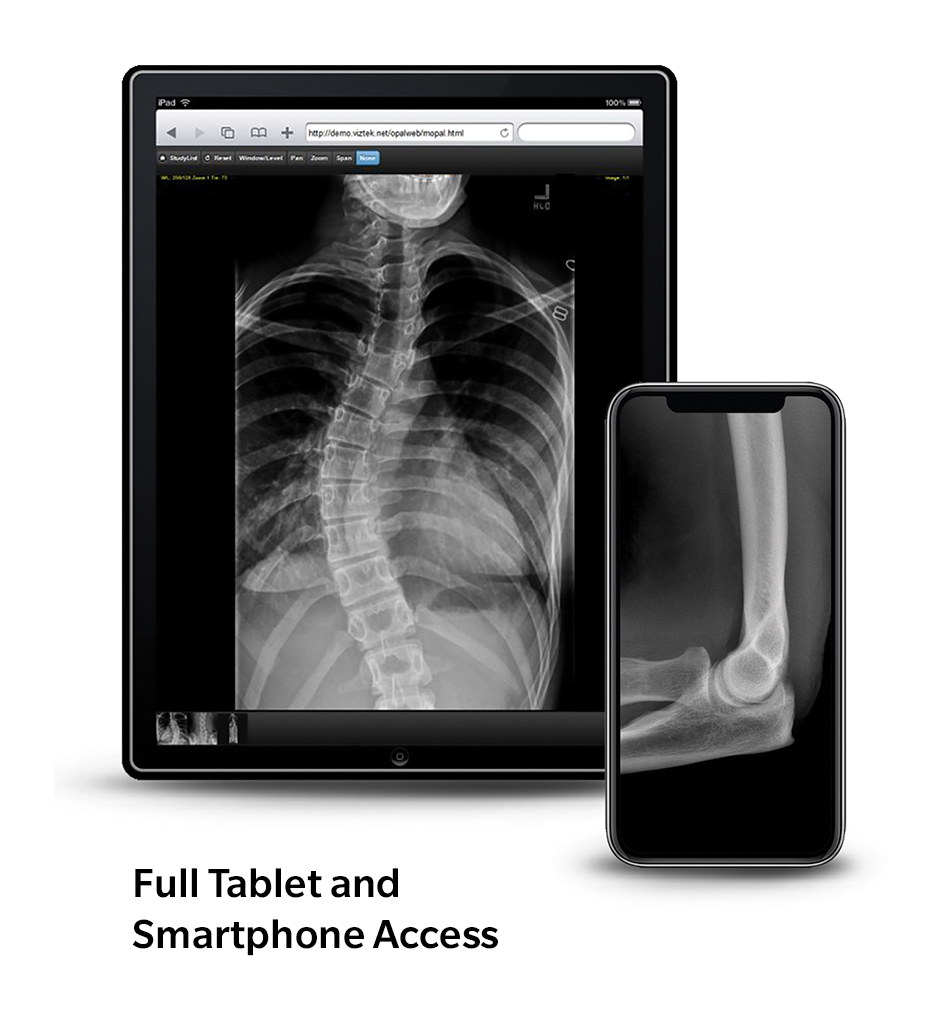 Full tablet and smartphone access