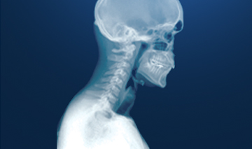 C-spine lateral x-ray