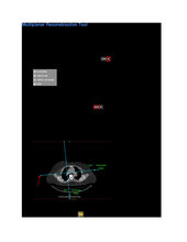 Multiplanar Reconstruction Tool.pdf