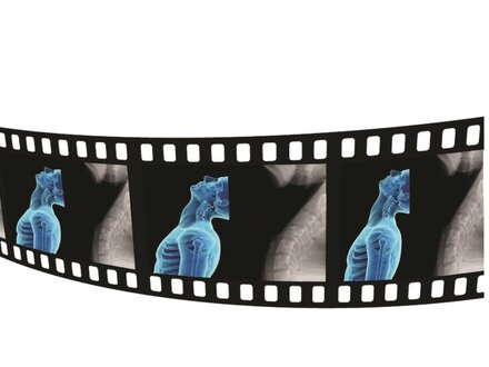 filmstrip of x-ray images