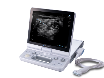 HS2 with probe showing SNV software