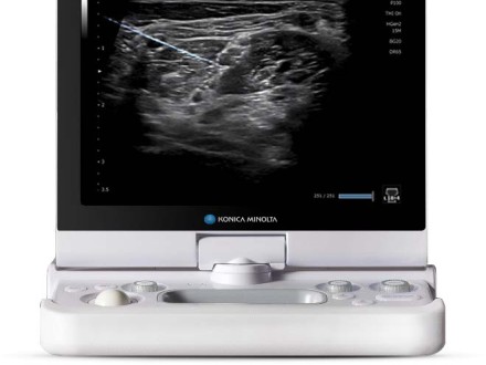 SNV software screen on an HS1 device