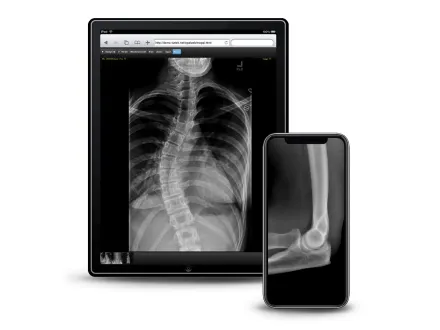 x-ray on mobile devices