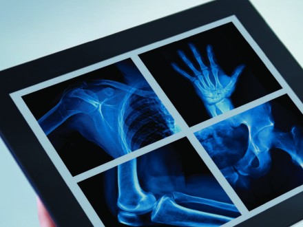 tablet screen with EXA software