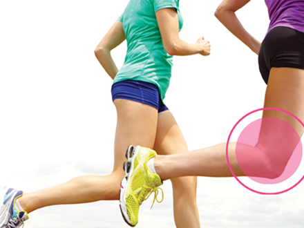 female runners highlighting the runners knee