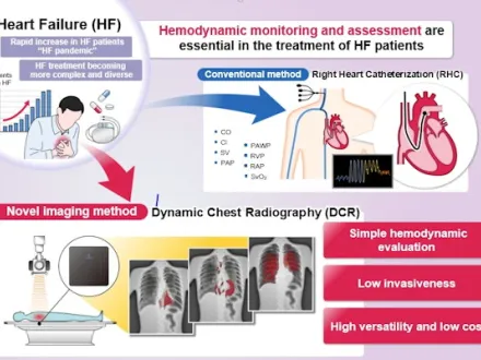 diagram showing DDR use for detecting heart falure