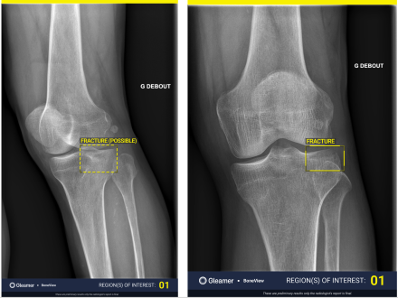 Combined photo of the two different confidence levels
