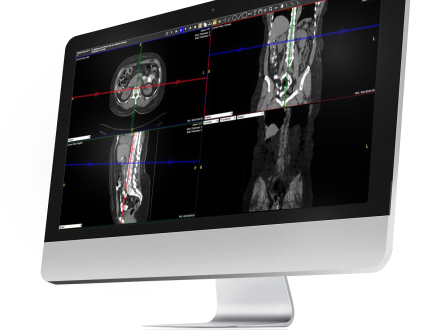 A flat screen computer monitor featuring images uploaded into Exa PACS