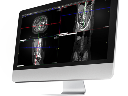 A flat screen computer monitor featuring images uploaded into Exa PACS
