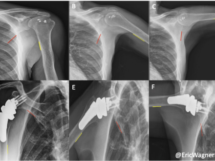 Images of shoulder biomechanics