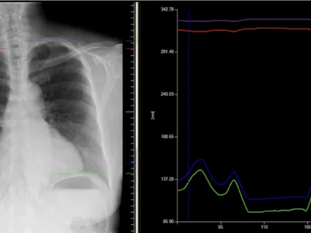 A view of a DDR  applied image on a computer screen