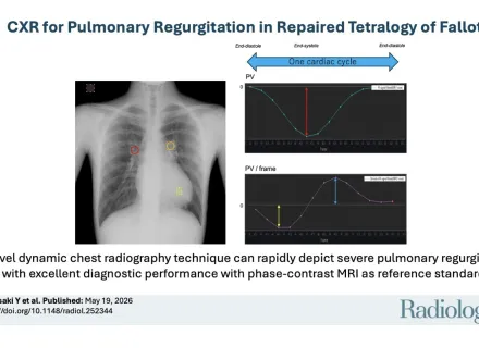 An image and data to support the study about DDR in Pulmonary Regurgitation