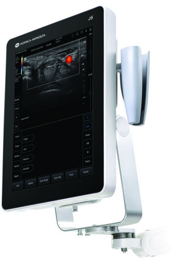 J5 Ultrasound System Konica Minolta Healthcare Americas, Inc.