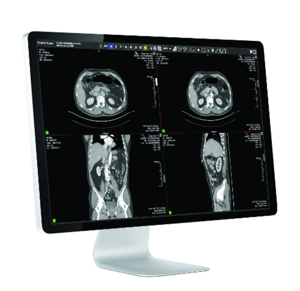 Exa PACS | Konica Minolta Healthcare Americas, Inc.