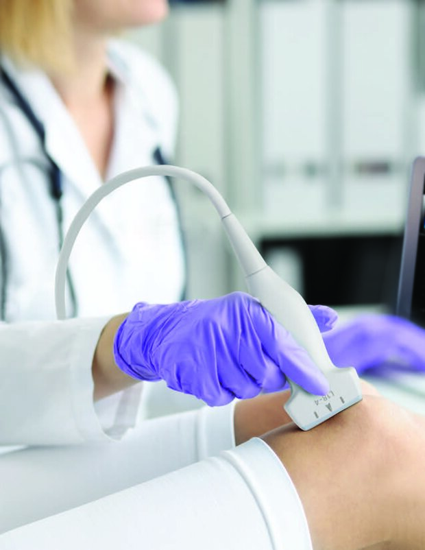 SONIMAGE MX1 Platinum Ultrasound System | Konica Minolta