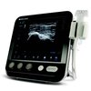 SONIMAGE MX1 Portable Ultrasound System | Konica Minolta Healthcare ...