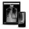 x-ray on mobile devices