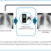 A Bone Suppression Imaging workflow chart