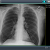 A screen capture of a chest image on CS7