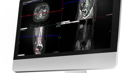 A flat screen computer monitor featuring images uploaded into Exa PACS