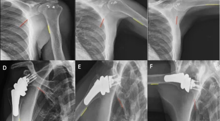 Images of shoulder biomechanics