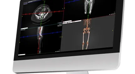 Exa Viewer with 4 scans on it 