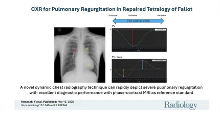 An image and data to support the study about DDR in Pulmonary Regurgitation