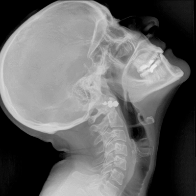 xray frame of head from a DDR video