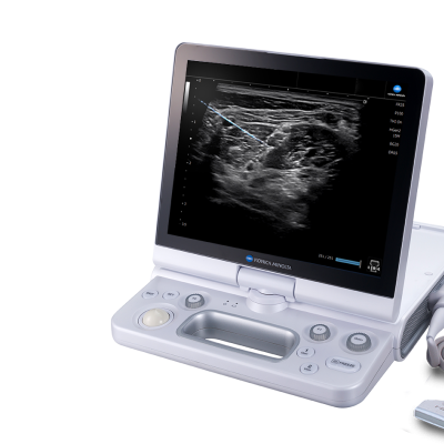 HS2 with probe showing SNV software