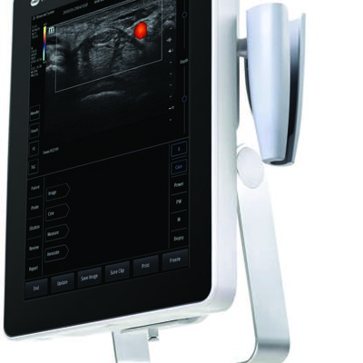 J5 Portable Ultrasound system