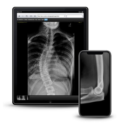 x-ray on mobile devices