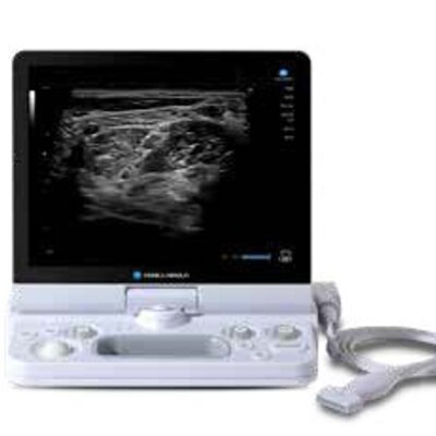 SONIMAGE MX1 Portable Ultrasound System | Konica Minolta Healthcare ...