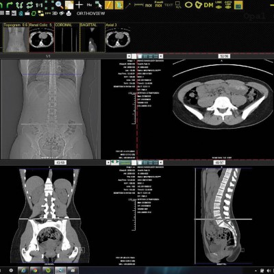 image viewer on exa lite