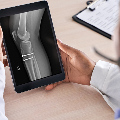 doctor viewing x-ray with the Symmetry PACS zero footprint viewer on a tablet