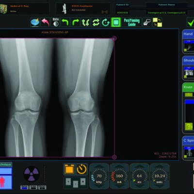 Ultra DR software console screen