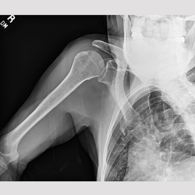sample images from a series of shoulder x-rays from the dynamic digital radiography software