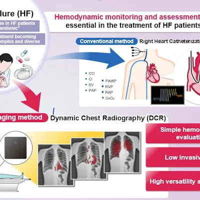 diagram showing DDR use for detecting heart falure