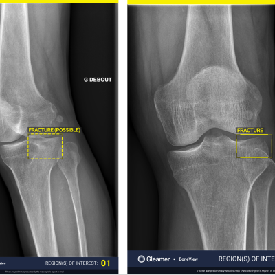 Combined photo of the two different confidence levels