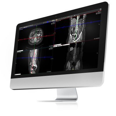 A flat screen computer monitor featuring images uploaded into Exa PACS