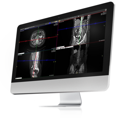 A flat screen computer monitor featuring images uploaded into Exa PACS