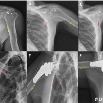 Images of shoulder biomechanics