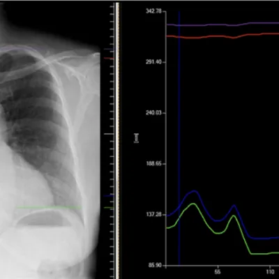 A view of a DDR  applied image on a computer screen