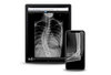 x-ray on mobile devices