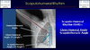 An x-ray from dynamic digital radiography of the shoulder 