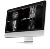 A flat screen computer monitor featuring images uploaded into Exa PACS