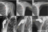 Images of shoulder biomechanics